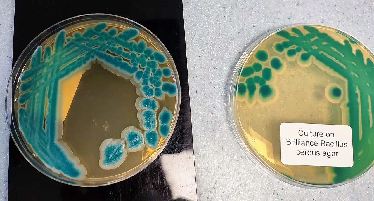 Bacillus cereus colonies on the indicator media.jpg